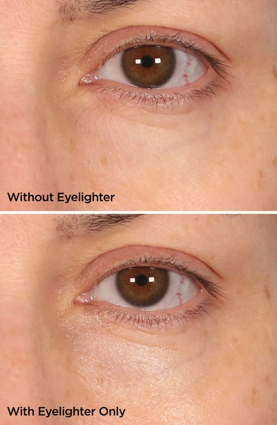 Beautybio The Eyelighter Concentrate With Vitamin C & Plant Powered-retinol 0.5 oz/ 15 ml