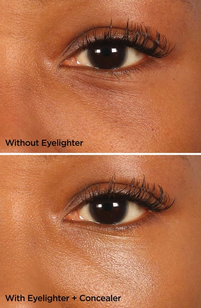 Shop Beautybio The Eyelighter Concentrate Smoothing, Brightening Serum & Depuffing Tool