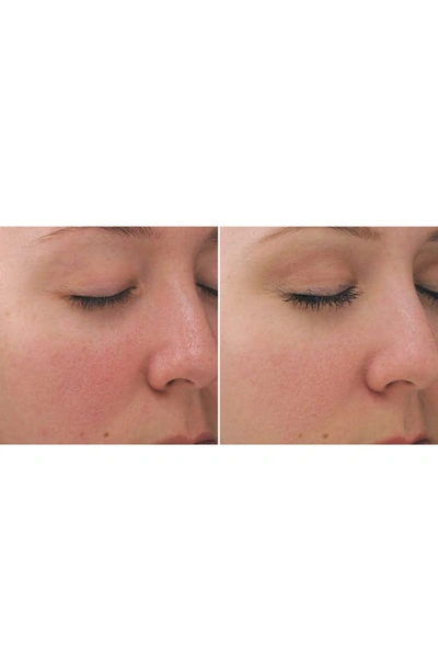 Pca Skin Dual Action Redness Relief Corrective Cream