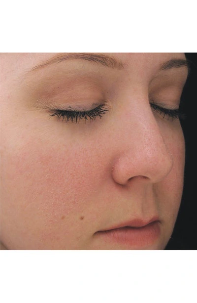 Pca Skin Dual Action Redness Relief Corrective Cream