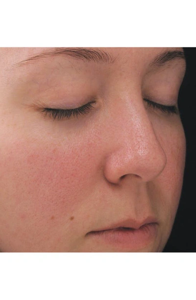 Pca Skin Dual Action Redness Relief Corrective Cream