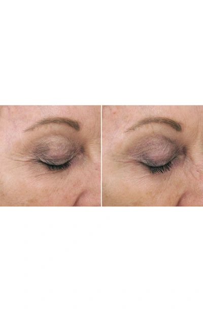 Pca Skin Rejuvenating Serum