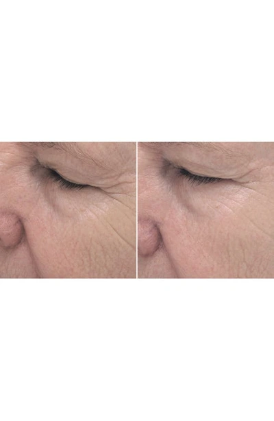 Pca Skin Exlinea Peptide Smoothing Serum