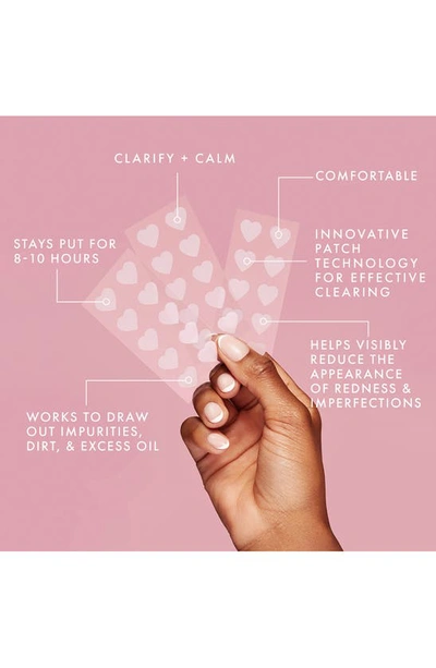 Kylie Skin Clarifying Patches