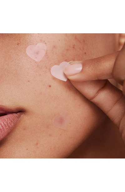 Kylie Skin Clarifying Patches