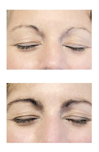 Neulashr Neulash® Neubrow® Brow Enhancing Serum
