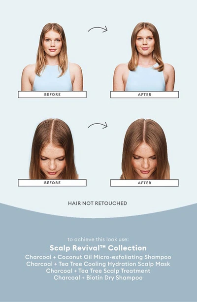 Briogeo Scalp Revival Soothe + Detoxify Travel Set For Dry Itchy, Oily Scalp