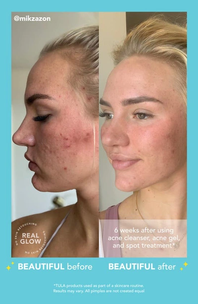 Shop Tula Skincare Go Away Acne Spot Treatment