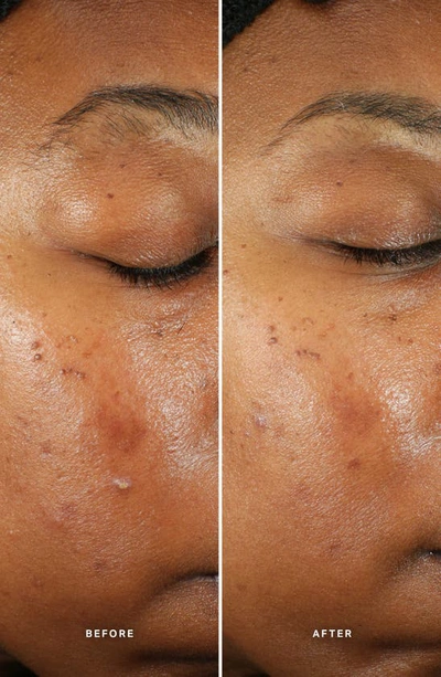 Alpha-h Generation Glow Daily Resurfacing Essence With 5% Aha Complex 100ml