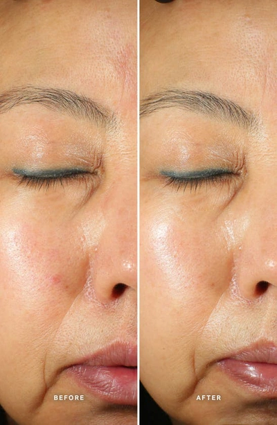 Alpha-h Generation Glow Daily Resurfacing Essence With 5% Aha Complex 100ml