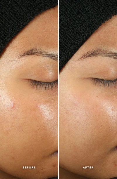 Alpha-h Generation Glow Daily Resurfacing Essence With 5% Aha Complex 100ml