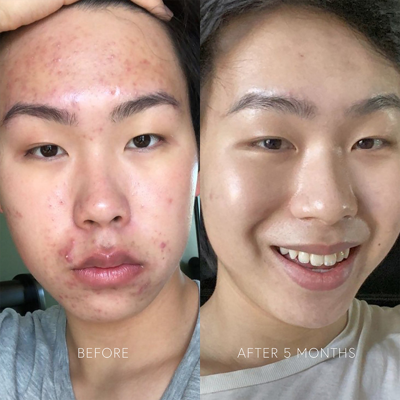 Dr Barbara Sturm Clarifying Serum In Default Title