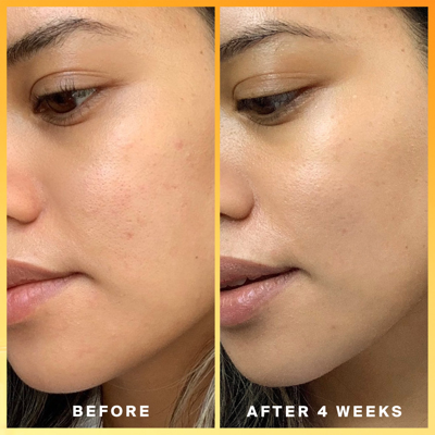Supergoop Daily Dose Vitamin C Spf 40 In Default Title