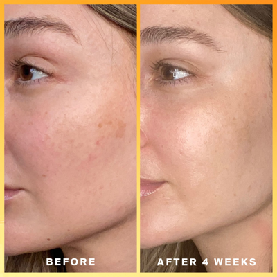 Supergoop Daily Dose Vitamin C Spf 40 In Default Title