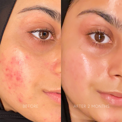 Dr Barbara Sturm Enzyme Cleanser In Default Title