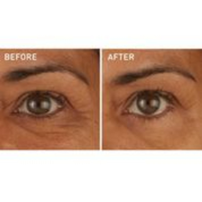 Skyn Iceland Hydro Cool Firming Eye Gels In Default Title