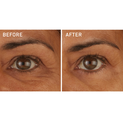 Skyn Iceland Hydro Cool Firming Eye Gels 4-pack In Default Title