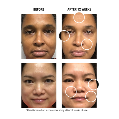 Kiehl's Since 1851 Micro-dose Anti-aging Retinol Serum With Ceramides And Peptide In Default Title