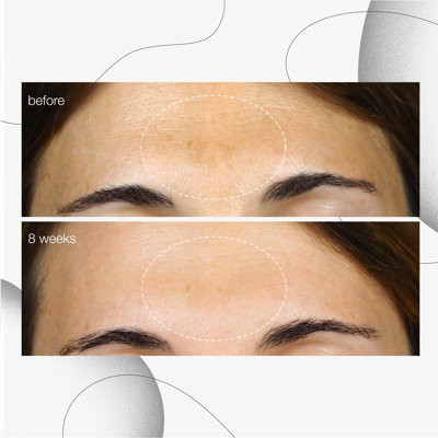 Dermalogica Powerbright Dark Spot Corrector Serum In Default Title