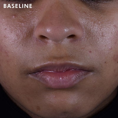 Skinceuticals Phloretin Cf With Ferulic Acid Vitamin C Serum 30ml In Default Title