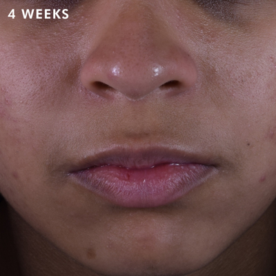 Skinceuticals Phloretin Cf With Ferulic Acid Vitamin C Serum 30ml In Default Title