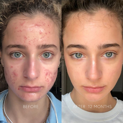 Dr Barbara Sturm Clarifying Face Cream In Default Title