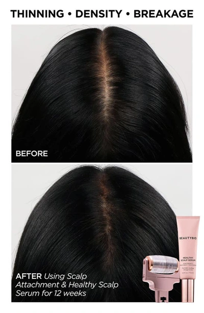 Shop Beautybio Glopro® Skin & Hair Goals Set $353 Value