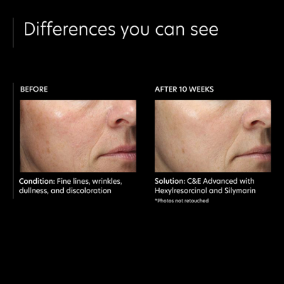 Pca Skin Cande Advanced In Default Title