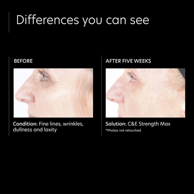 Pca Skin Cande Strength Max In Default Title