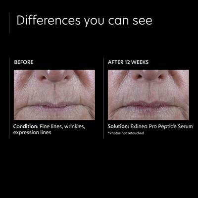 Pca Skin Exlinea Pro Peptide Serum In Default Title