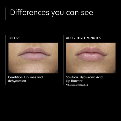 Pca Skin Hyaluronic Acid Lip Booster In Default Title