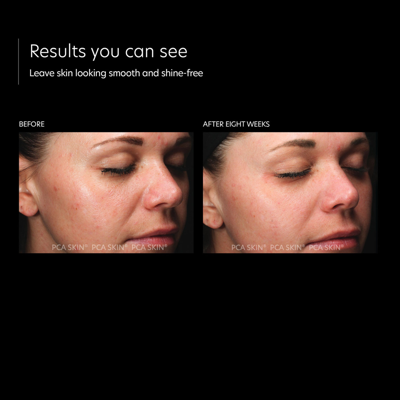 Pca Skin Hydramatte In Default Title