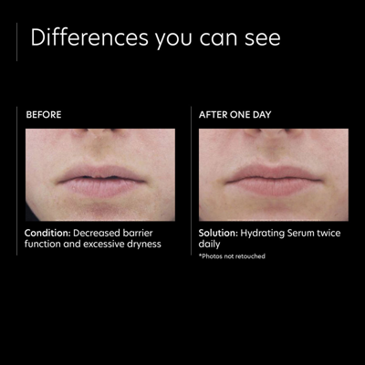 Pca Skin Hydrating Serum In Default Title