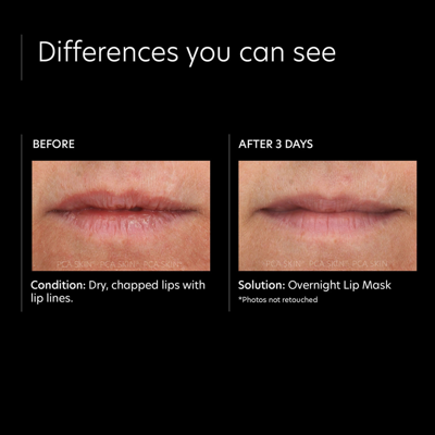 Pca Skin Overnight Lip Mask In Default Title