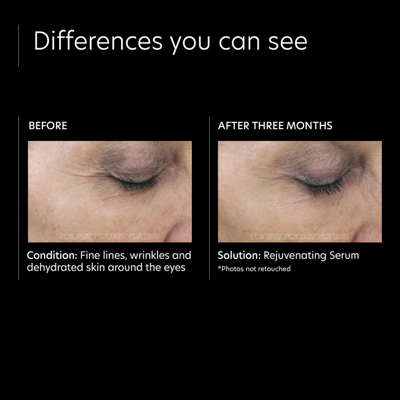 Pca Skin Rejuvenating Serum In Default Title