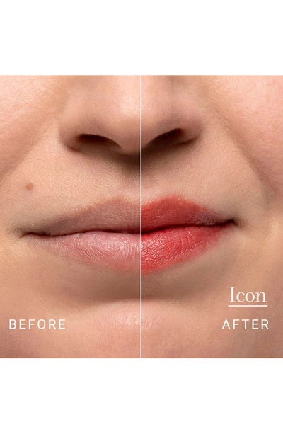 Fresh Sugar Lip Treatment In Multi