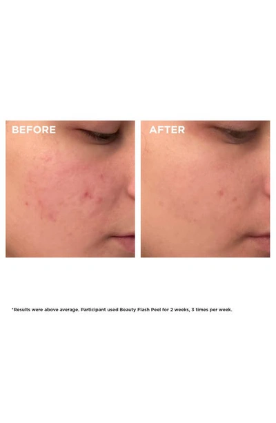 Clarins Beauty Flash Peel