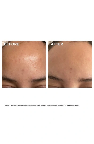 Clarins Beauty Flash Peel