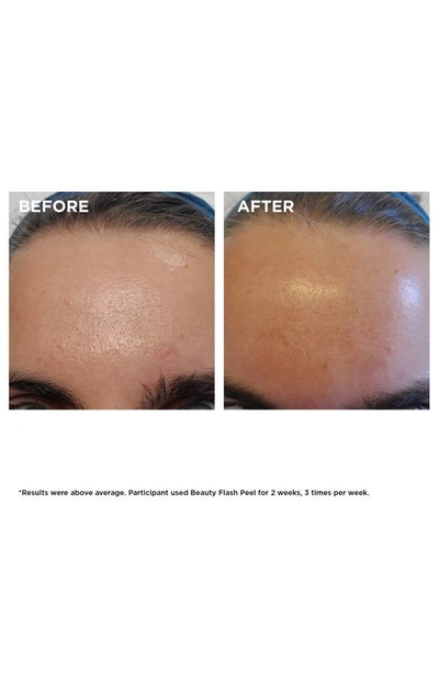 Clarins Beauty Flash Peel