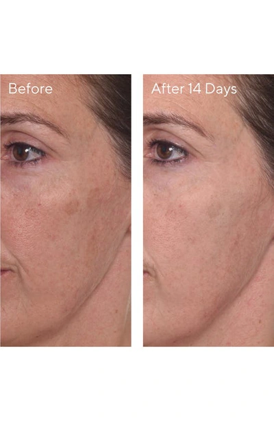 Murad Mini Rapid Dark Spot Correcting Serum 0.33 oz/ 10 ml