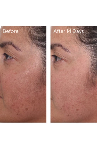 Murad Mini Rapid Dark Spot Correcting Serum 0.33 oz/ 10 ml