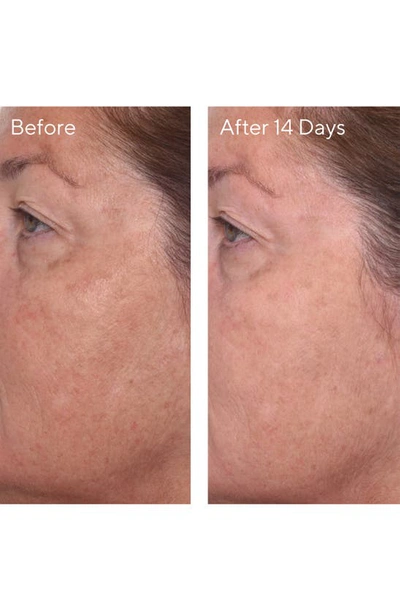 Murad Rapid Dark Spot Correcting Serum, One Size oz