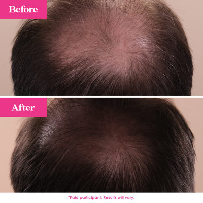 Grande Cosmetics Grandehair