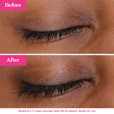 Grande Cosmetics Grandelash-md Lash Enhancing Serum