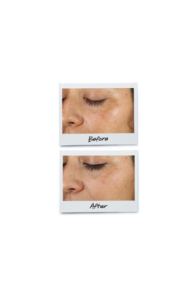 Kiehl's Since 1851 Dermatologist Solutions Clearly Corrective Dark Spot Solution, 1-oz.
