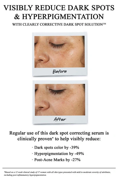 Kiehl's Since 1851 Dermatologist Solutions Clearly Corrective Dark Spot Solution, 1-oz.