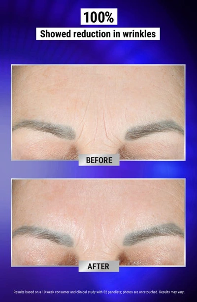 Kiehl's Since 1851 Retinol Fast-release Wrinkle Reducing Night Serum 1 oz / 30 ml 1 oz / 30 ml
