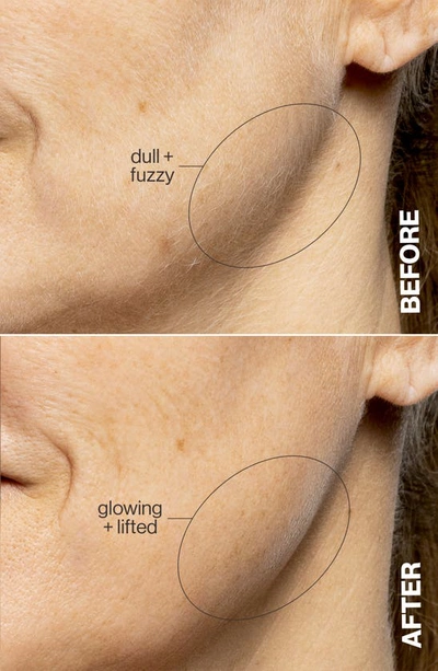 Dermaflash Luxe+ Advanced Sonic Dermaplaning And Peach Fuzz Removal - Pop Pink In Pop Pink