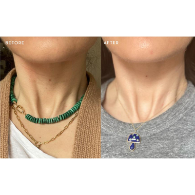 The Light Salon Boost Led Collar In Default Title