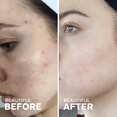 Three Ships Dew Drops Mushroom Hyaluronic Acid + Vitamin C Serum